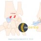 Visuel Imosteo d'une articulation osseuse
